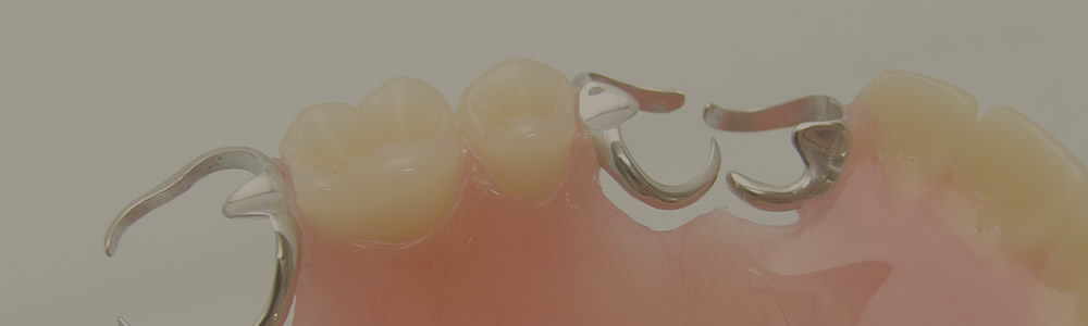 入れ歯(義歯)治療